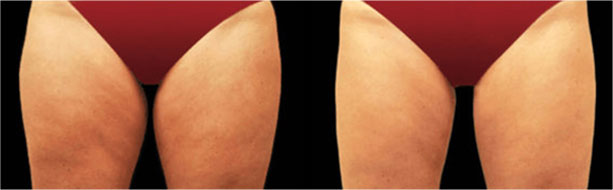 a close-up of a woman's back