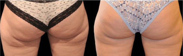 a comparison of women's legs