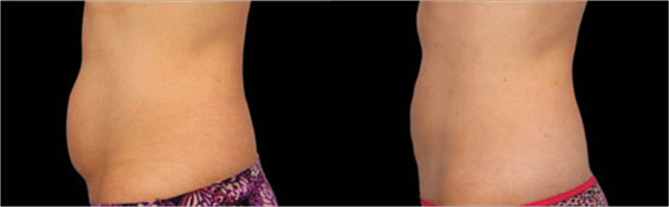 close-up of a woman's body
