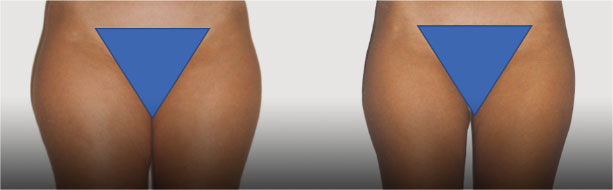 close-up of a woman's buttocks