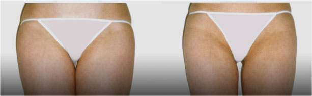 close-up of a woman's legs