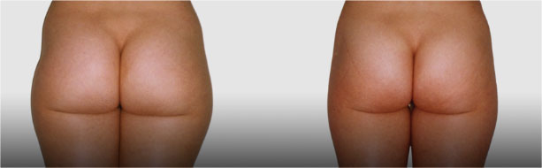 close-up of a person's legs