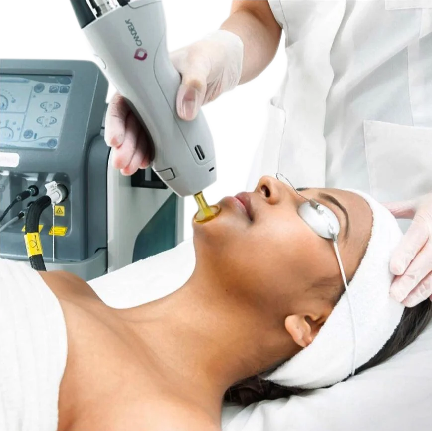 Laser Skin Tightening in New York, NY