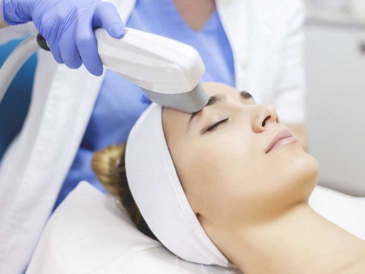 IPL Photofacial Services in New York, NY