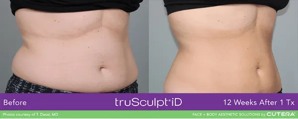 a comparison of a woman's belly