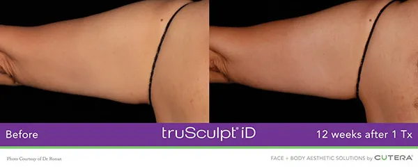 a close-up of a woman's arm