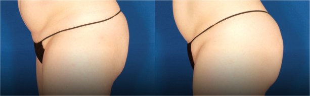 a collage of women's buttocks