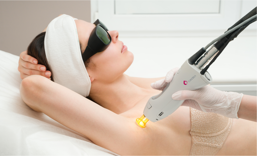 Laser Pigmentation Removal in New York, NY