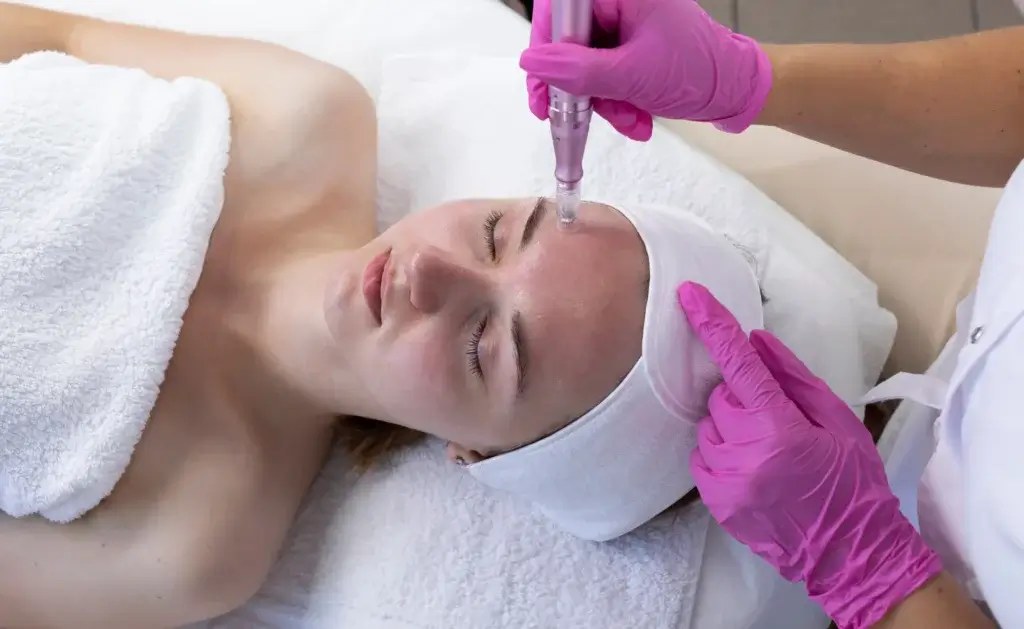 Microneedling by IN•GLO™ Face and Body Sculpting Med Spa in New York, NY