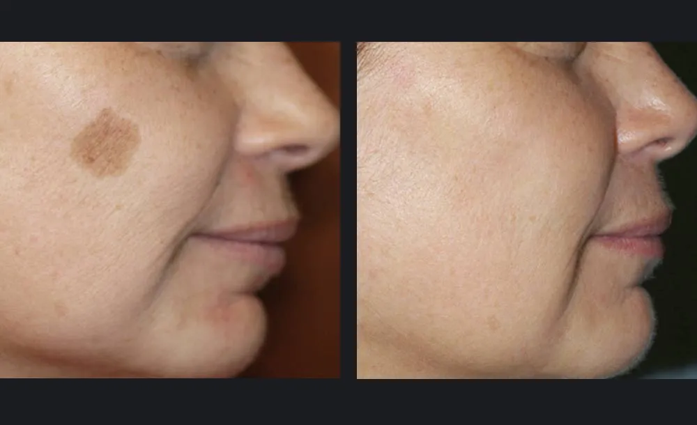gentlemax-age-spots-jill-waibel-md-p1.jpg